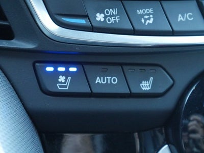 2021 Acura TLX A-Spec Package